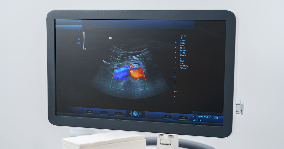 Ultrasonic device with AI